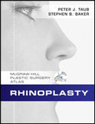 Rhinoplasty