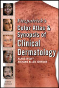 Fitzpatrick's color atlas and synopsis of clinical dermatology