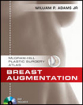 Breast augmentation: an operative atlas