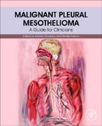 Malignant Pleural Mesothelioma