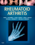 Rheumatoid arthritis