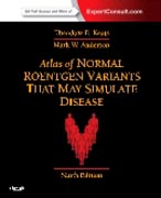 Atlas of normal Roentgen variants that may simulate disease: expert consult - enhanced online features and print