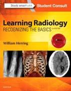 Learning Radiology: Recognizing the Basics