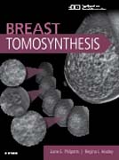 Breast Tomosynthesis