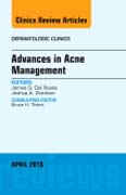 Advances in Acne Management, An Issue of Dermatologic Clinics