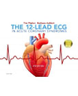 The 12-Lead ECG in Acute Coronary Syndromes