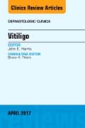 Vitiligo, An Issue of Dermatologic Clinics