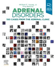 Adrenal Disorders: 100 Cases from the Adrenal Clinic