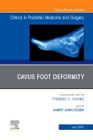 Cavus Foot Deformity, An Issue of Clinics in Podiatric Medicine and Surgery