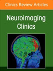 Spinal Tumors, An Issue of Neuroimaging Clinics of North America