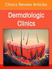 Diagnosing Skin Disease in Skin of Color, An Issue of Dermatologic Clinics