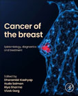 Cancer of the breast: Epidemiology, diagnostics and treatment