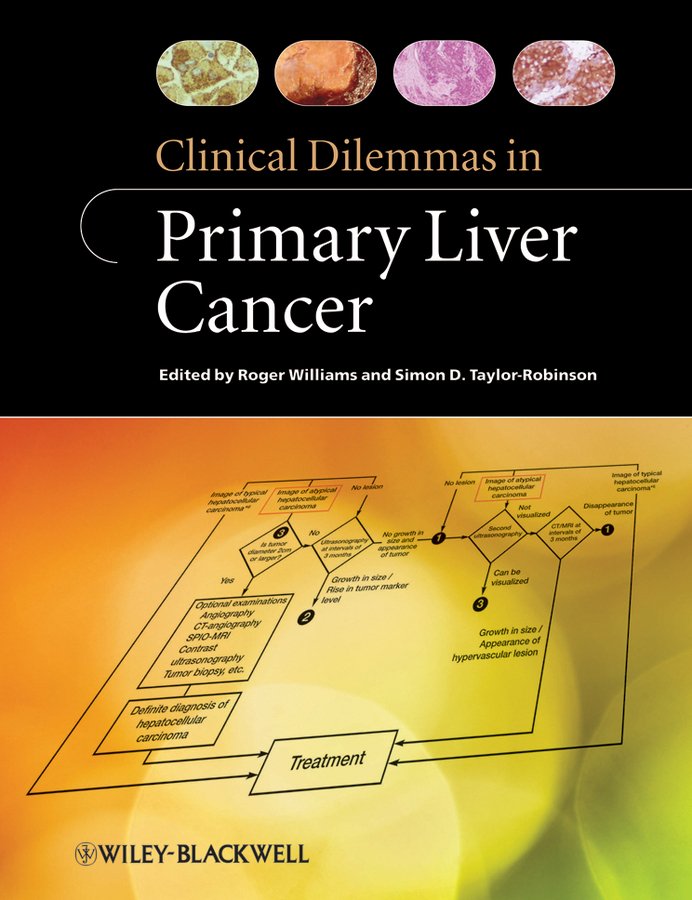 Clinical dilemmas in primary liver cancer