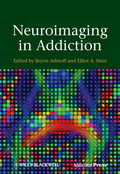 Neuroimaging in addiction