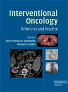 Interventional oncology: principles and practice