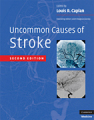 Uncommon causes of stroke