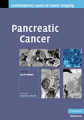 Pancreatic cancer