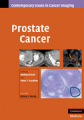 Prostate cancer