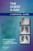 The chest x-ray: a survival guide