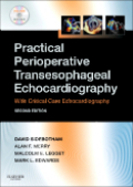 Practical perioperative transesophageal echocardiography