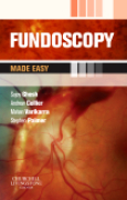 Fundoscopy