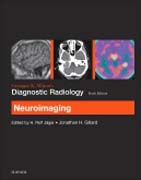 Grainger & Allisons Diagnostic Radiology: Neuroimaging