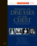 Imaging of diseases of the chest