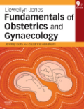 Llewellyn-Jones fundamentals of obstetrics and gynaecology