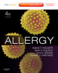 Allergy: expert consult online and print