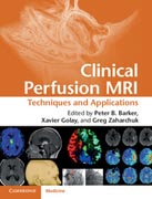 Clinical Perfusion MRI: Techniques and Applications