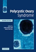 Polycystic Ovary Syndrome