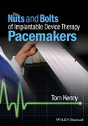 The Nuts and Bolts of Implantable Device Therapy: Pacemakers