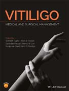 Vitiligo: Medical and Surgical Management