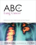 ABC of lung cancer