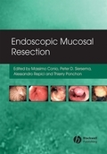 Endoscopic mucosal resection