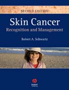 Skin cancer: recognition and management