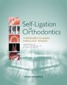 Self-ligation in orthodontics