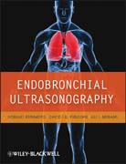 Endobronchial ultrasonography