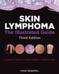 Skin lymphoma: the illustrated guide