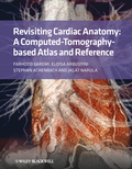 Revisiting cardiac anatomy: a computed-tomography-based atlas and reference