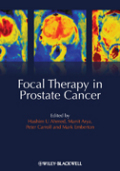 Focal therapy in prostate cancer