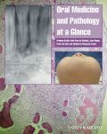 Oral medicine and pathology at a glance