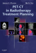 PET-CT in radiotherapy treatment planning