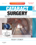 Cataract surgery