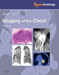 Imaging of the chest