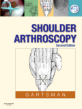 Shoulder arthroscopy