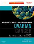 Ovarian cancer