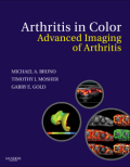 Arthritis in color: advanced imaging of arthritis