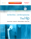 Arthritis and arthroplasty: the hip