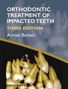 Orthodontic treatment of impacted teeth